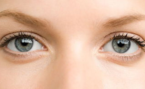 血管型黑眼圈可以采取脉冲光减少吗？