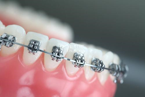 昆明市美国ICX种植牙口腔医生在榜名单前十名如期公布-昆明市美国ICX种植牙医生行业领头
