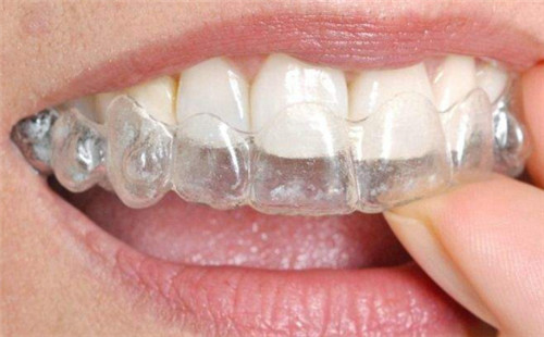 阜阳做人工种植牙常见的危害有哪些