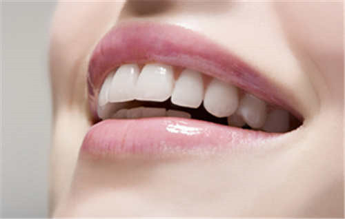 黄山托槽牙齿正畸对于女性的危害