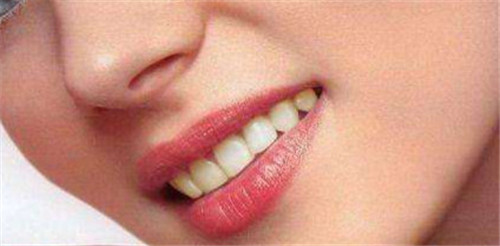 鄂尔多斯3d超薄牙贴面的最有效方法是什么